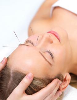 cosmetic acupuncture