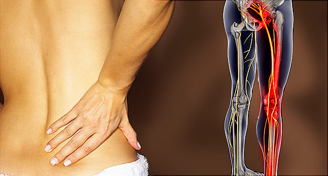 Low back pain and sciatic pain