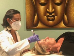 Read more about the article Microneedling: Feel and look like a Million Dollars!