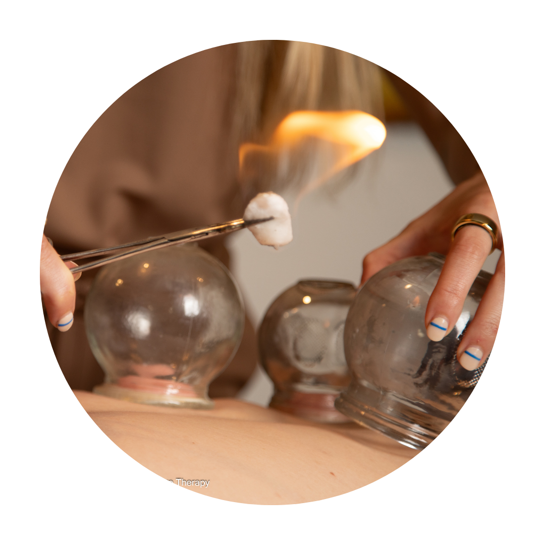 San Diego therapeutic cupping therapy session with cups placed on a client's back, promoting holistic healing and pain relief