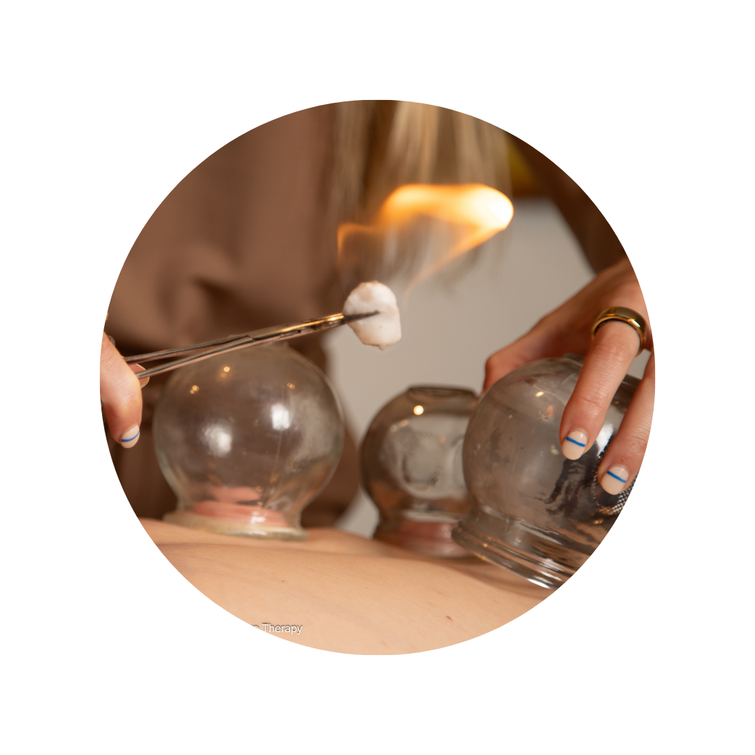 San Diego therapeutic cupping therapy session with cups placed on a client's back, promoting holistic healing and pain relief