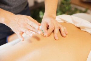 Read more about the article How Does Acupuncture Works San Diego Ca: Benefits, Science and What to Expect