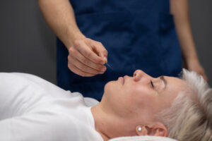 Read more about the article What Is Cosmetic Acupuncture? A Natural Way to Refresh Your Face