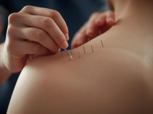 Read more about the article Five Elements Acupuncture Explained: Theory, Benefits, and Treatment Explained