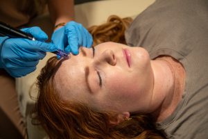 Read more about the article Radiofrequency Microneedling vs Regular Microneedling: Which Is Better?
