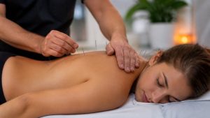 Read more about the article 5 Benefits of Acupuncture for Muscle Activation
