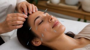 Read more about the article Facial Acupuncture Benefits Beyond Wrinkles: A Guide